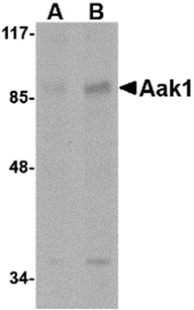 Aak1 Polyclonal Antibody, 100 µg
