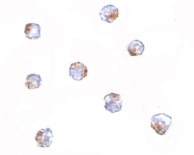 Aak1 Polyclonal Antibody, 100 µg