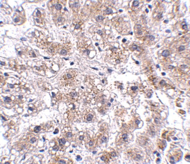 AFAP1L2 Polyclonal Antibody, 100 µg