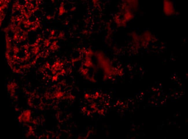 AGTR1 Polyclonal Antibody, 100 µg