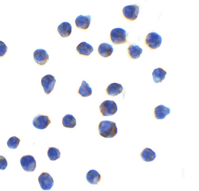 AGTR2 Polyclonal Antibody, 100 µg