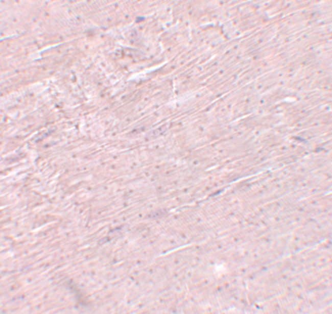 ADAMTSL5 Polyclonal Antibody, 100 µg