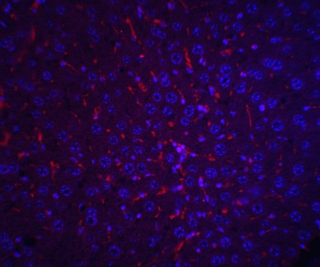 AFP Polyclonal Antibody, 100 µg