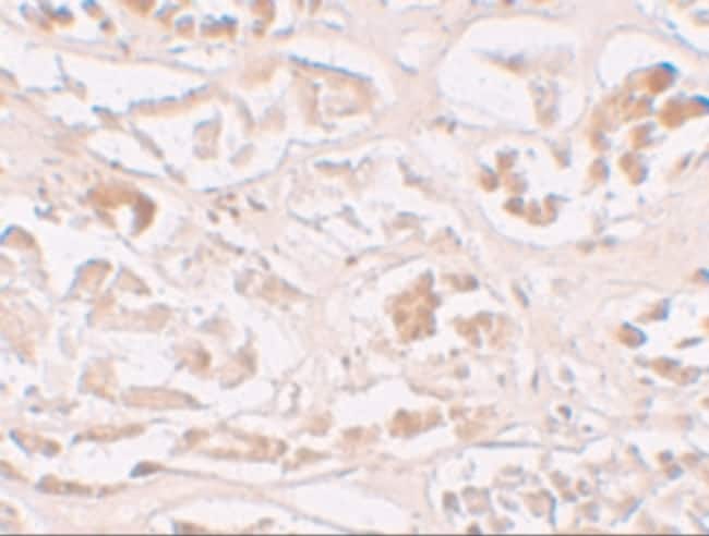 ALKBH2 Polyclonal Antibody, 100 µg