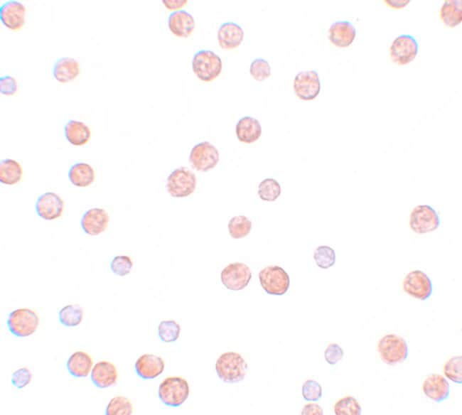 100UG PLAC3 POLYCLONAL ANTIBODY