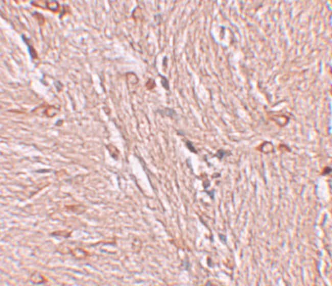 Anti-ZBTB4 polyclonal antibody, 100 µg a