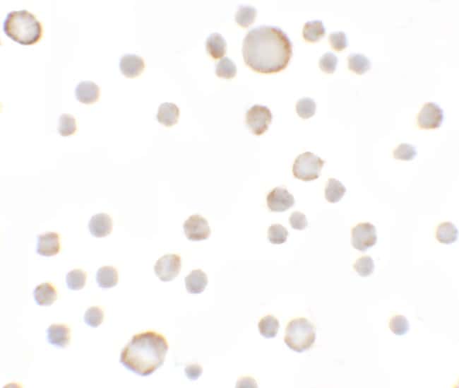 Anosmin Polyclonal Antibody, 100 µg