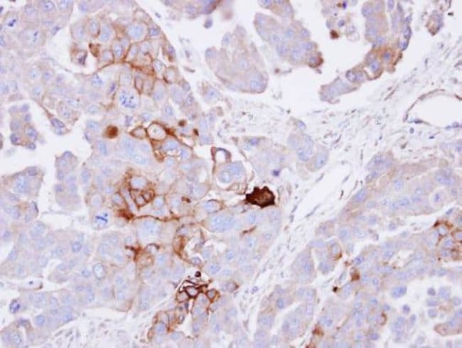 alkaline phosphatase (liver/bone/kidney)