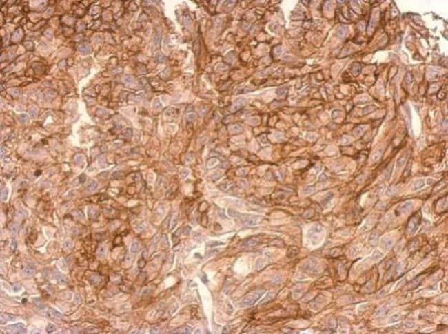 ADAMTSL-2 Polyclonal Antibody, 100 µg