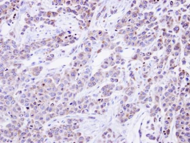 alpha Glucosidase II Polyclonal antibody