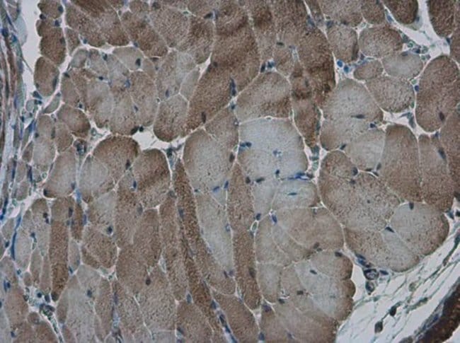 AMPK alpha 2 Polyclonal Antibody, 100 µl