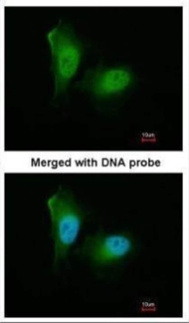 20S Proteasome alpha2 Polyclonal Antibod