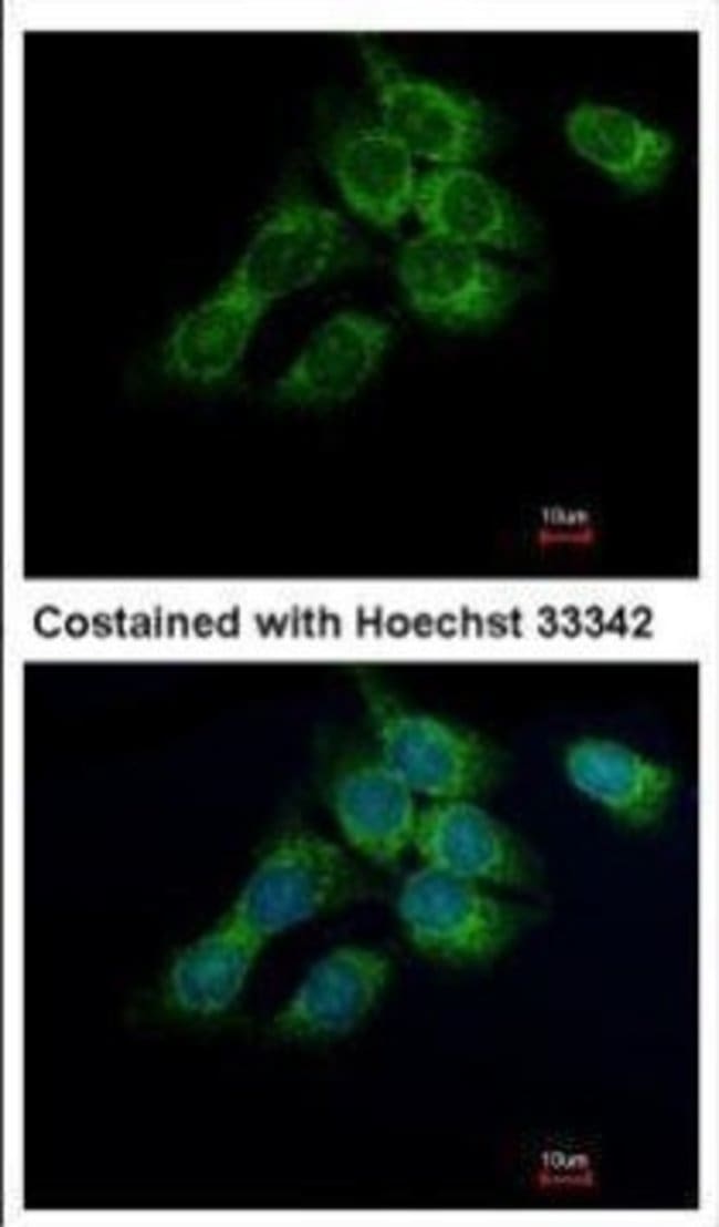 17beta-HSD4 Polyclonal Antibody, 100 µg