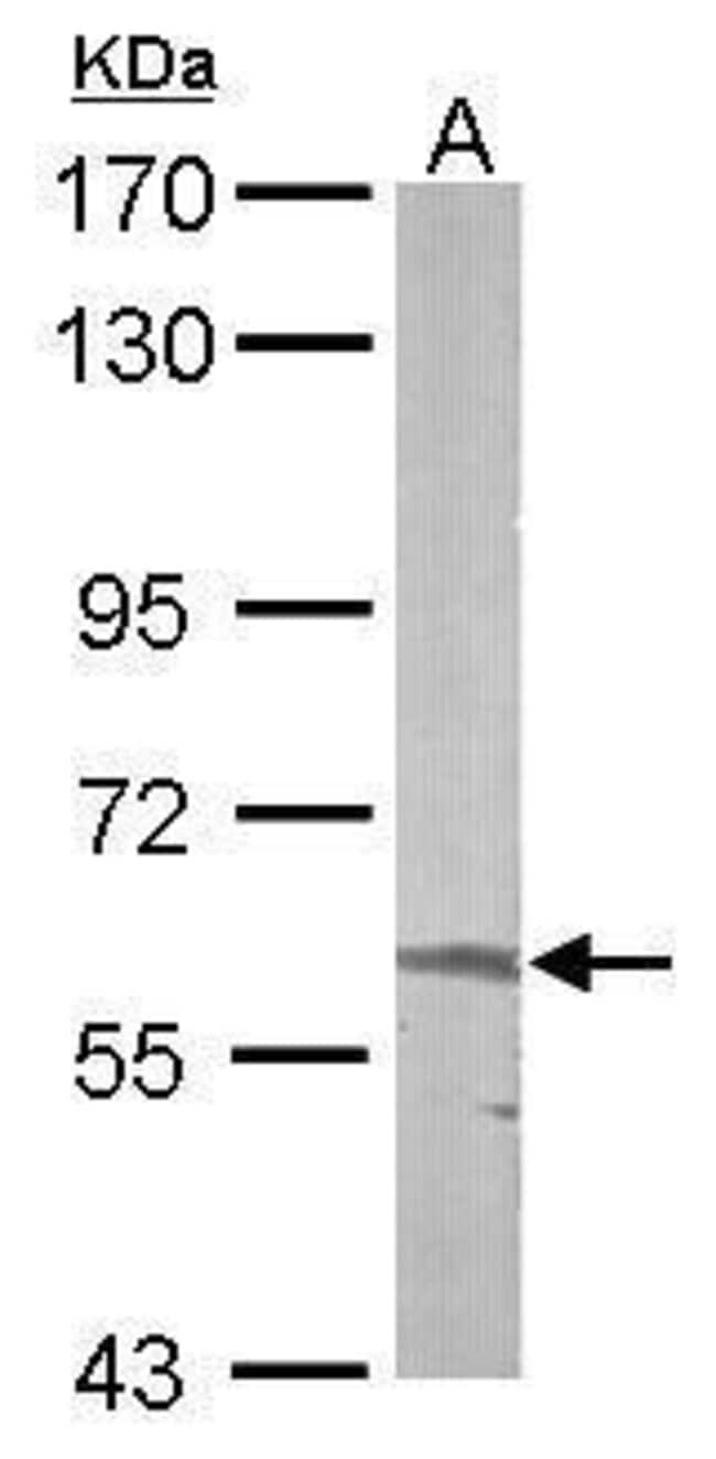 ALAS-E Polyclonal Antibody, 100 µg