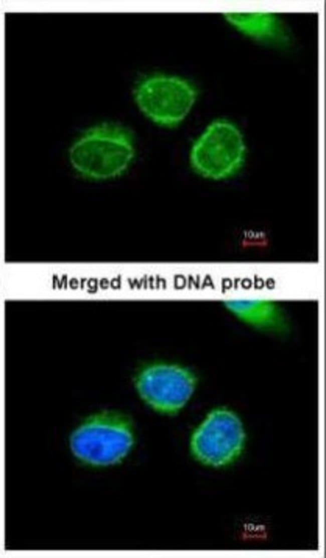 AKR7 Polyclonal Antibody, 100 µg
