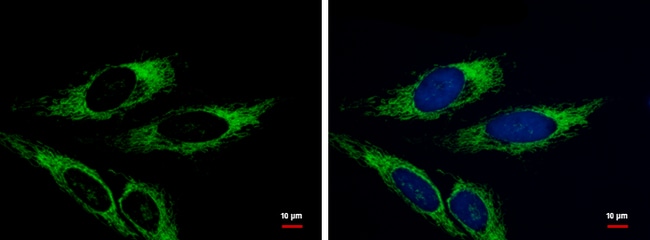 AK4 Polyclonal Antibody, 100 µg