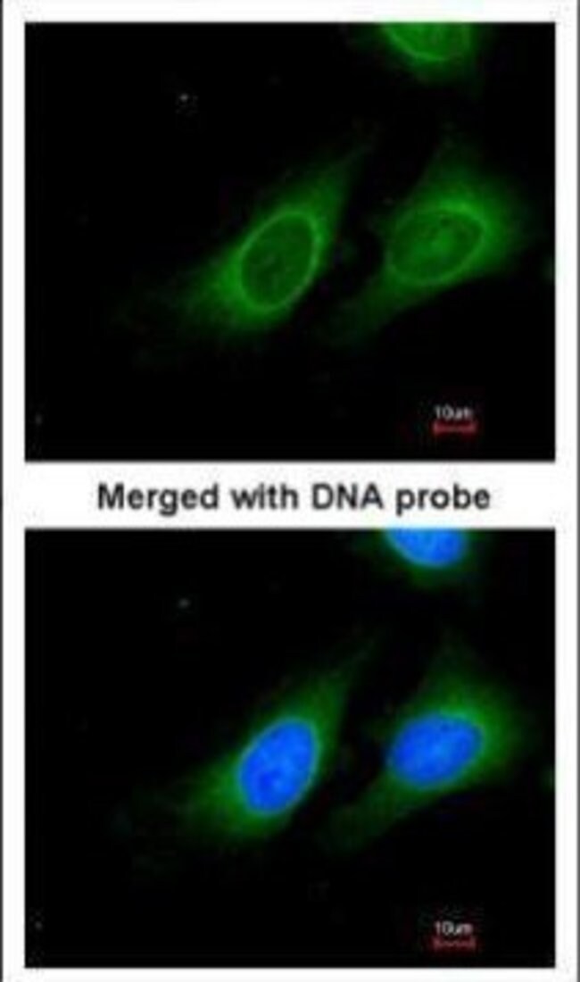 15-PGDH Polyclonal antibody, 100 µg
