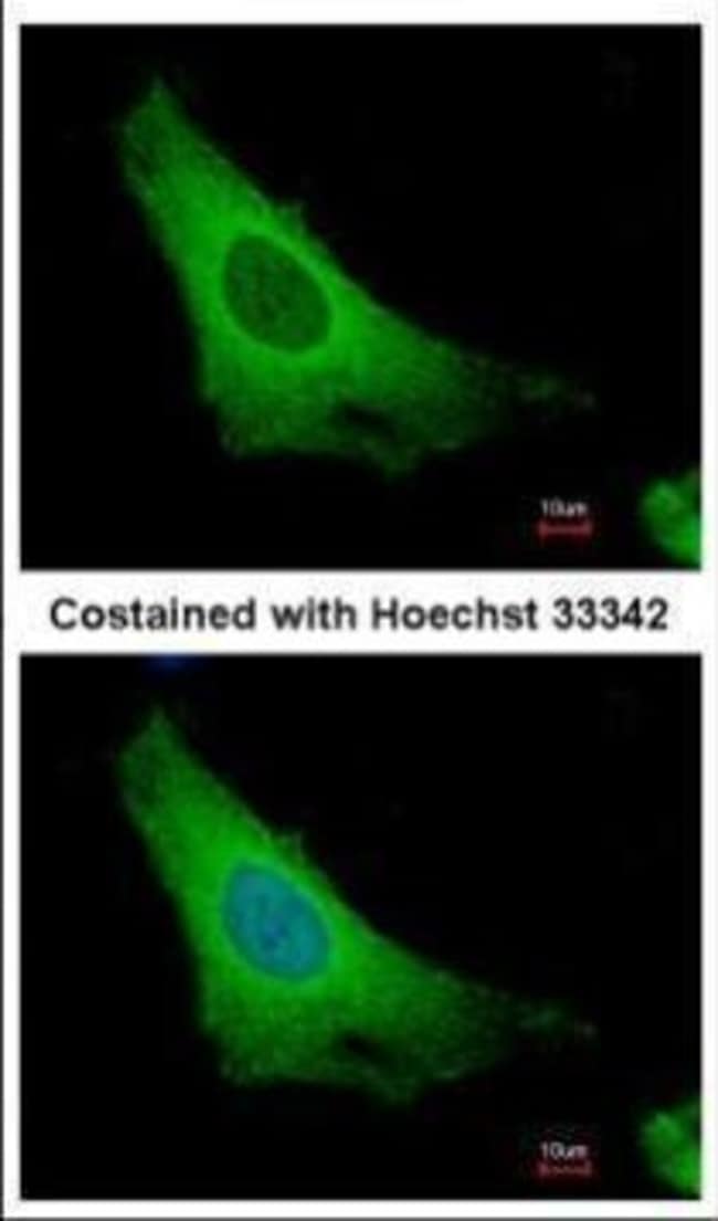 ADP-ribosylation factor 3 Polyclonal Ant