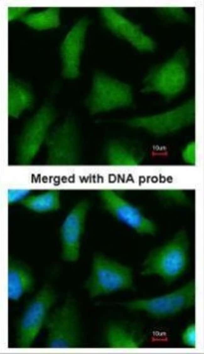 20S Proteasome alpha 6 Polyclonal Antibo