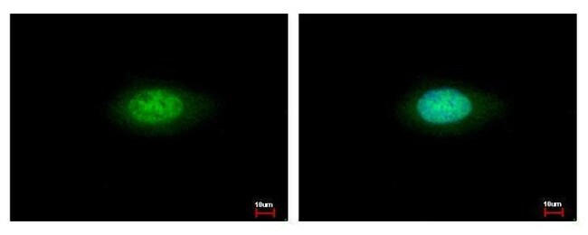 Annexin VII Polyclonal Antibody, 100 µl