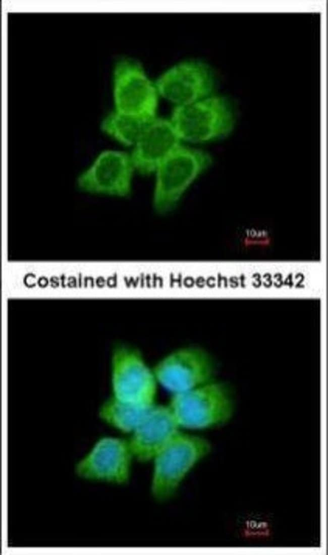 AKR1C1 Polyclonal Antibody, 100 µg