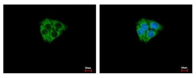 100µl DCAMKL2 Polyclonal Antibody