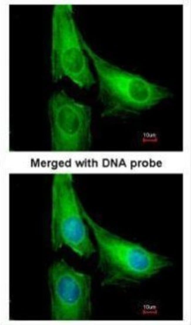 AGAP1 Polyclonal Antibody, 100 µg