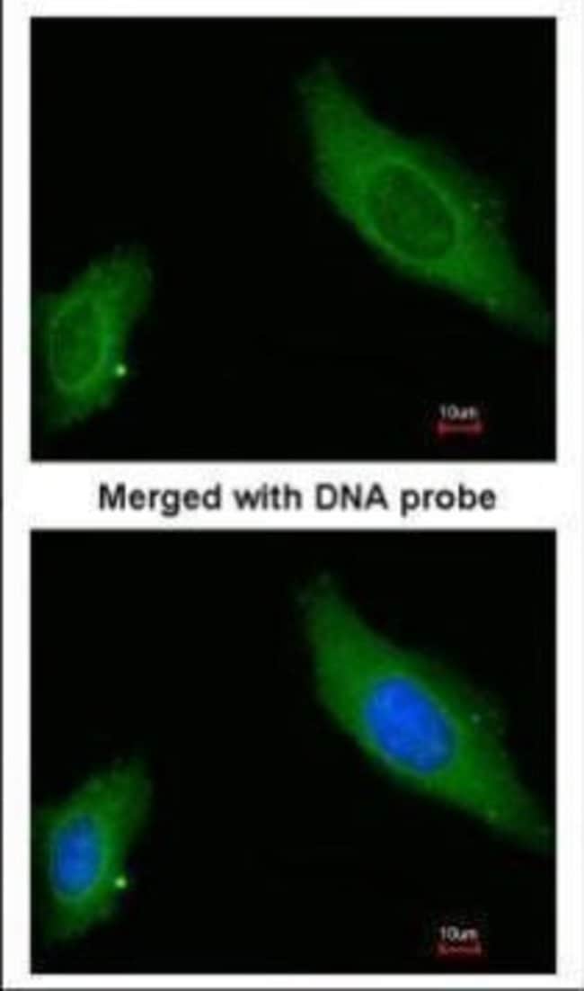 AKAP12 Polyclonal Antibody, 100 µl