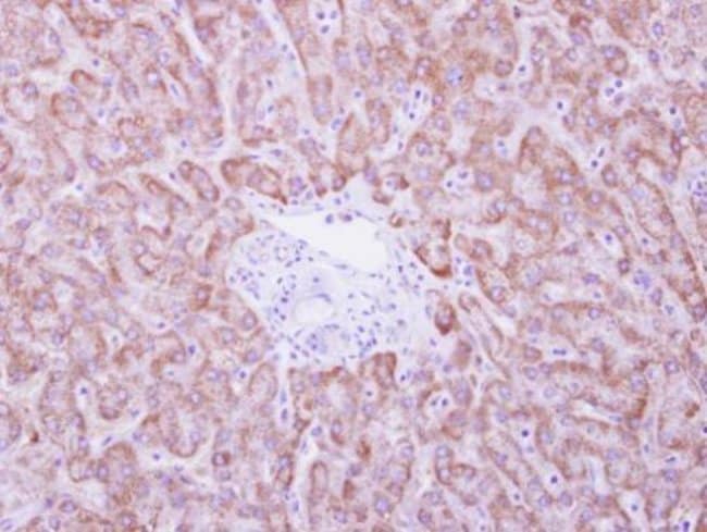 ankyrin repeat domain 45 Polyclonal Anti
