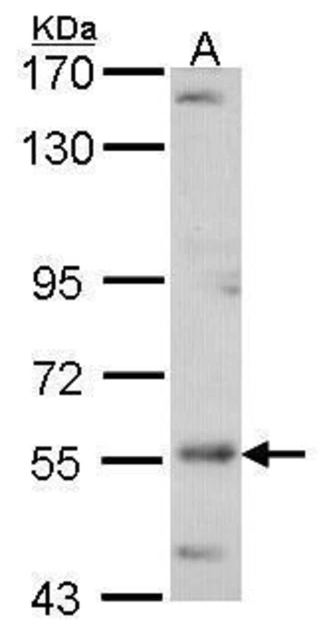 ADCK4 Polyclonal antibody, 100 µl