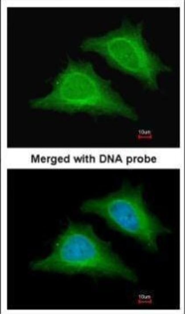 AMPK gamma-2 Polyclonal antibody, 100 µg