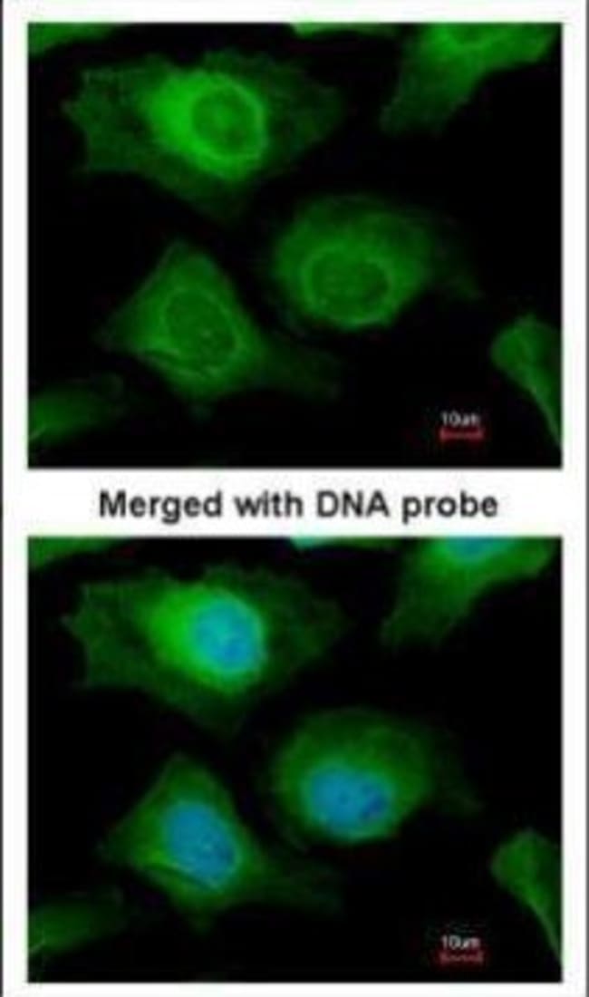 AKR1B10 Polyclonal antibody, 100 µg