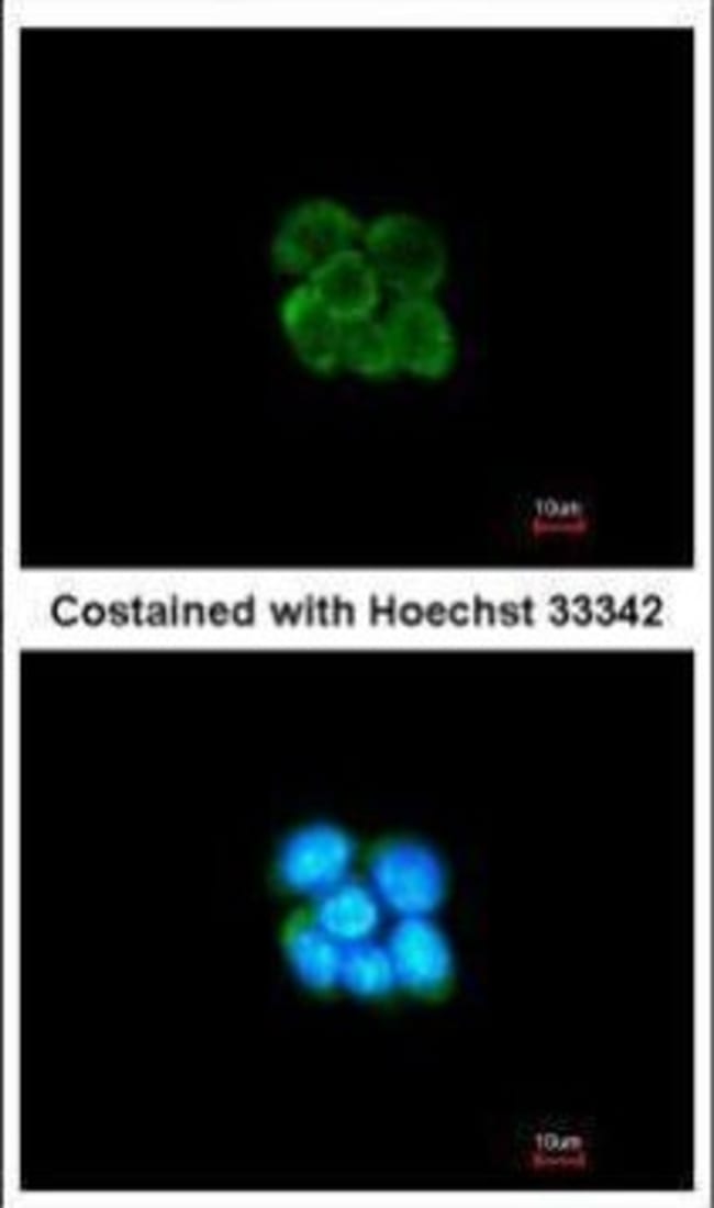 alpha-2 antiplasmin Polyclonal Antibody,