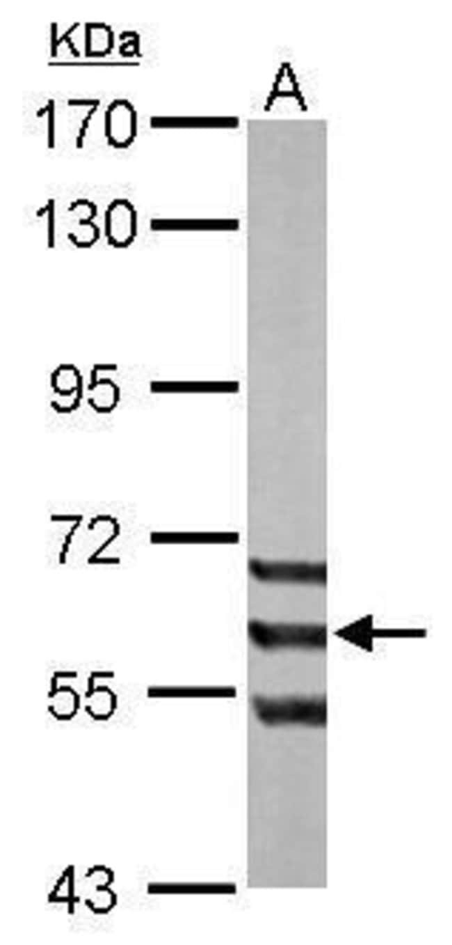 ADCK1 Polyclonal Antibody, 100 µg