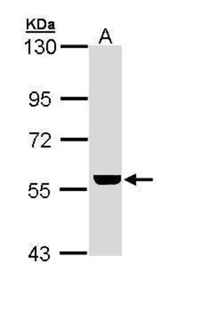 ADCK4 Polyclonal antibody, 100 µg