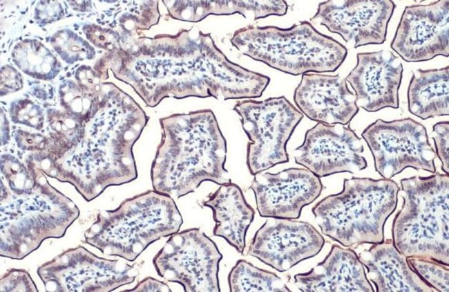 alkaline phosphatase (intestinal) Polycl