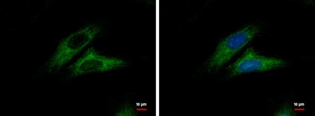 Alpha-catulin Polyclonal Antibody, 100 µ