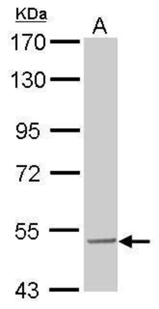 100UG SESN3 POLYCLONAL ANTIBODY