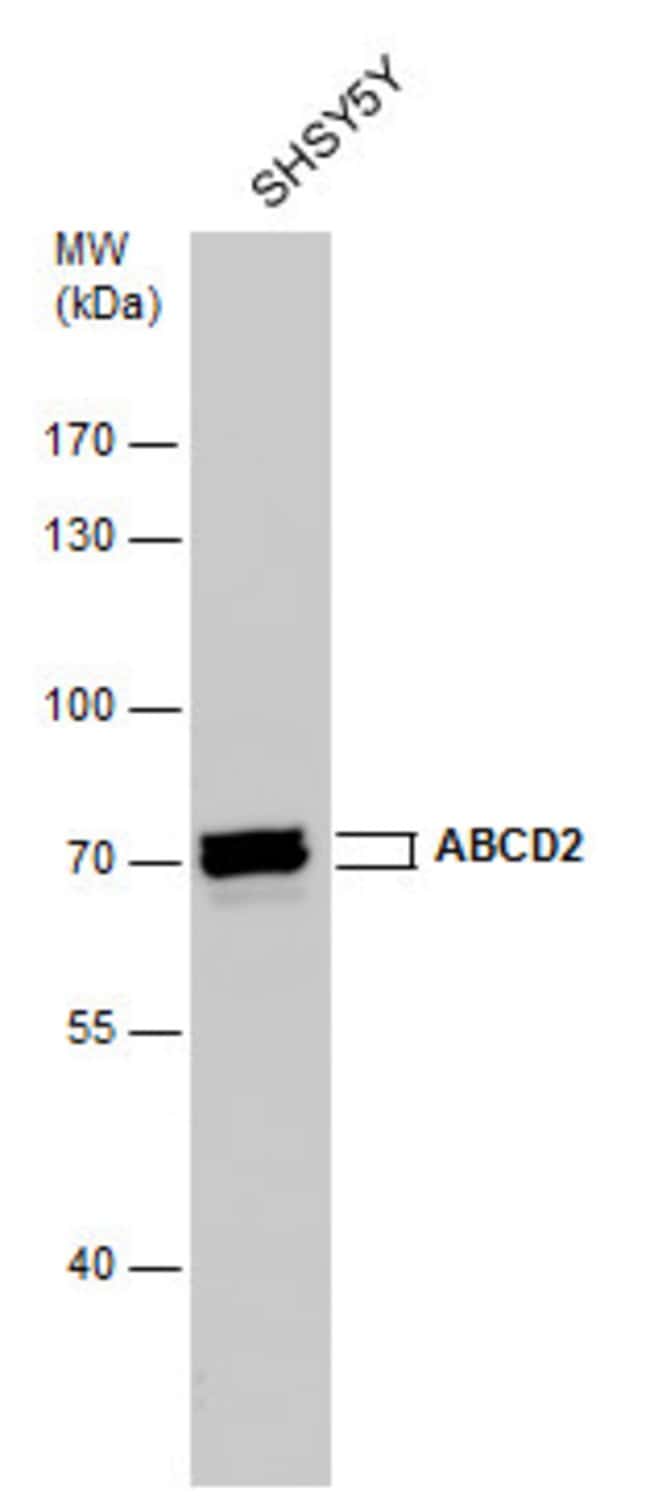 ABCD2 Polyclonal Antibody, 100 µl