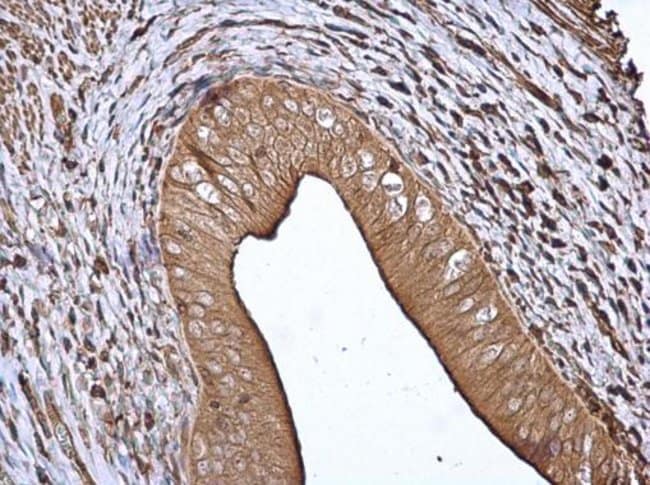 14-3-3 beta Polyclonal Antibody, 100 µg