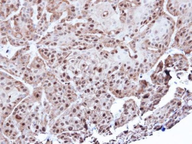 Annexin A1 Polyclonal Antibody, 100 µg