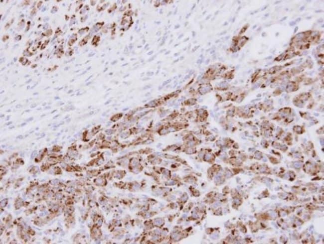 20S Proteasome alpha3 Polyclonal Antibod