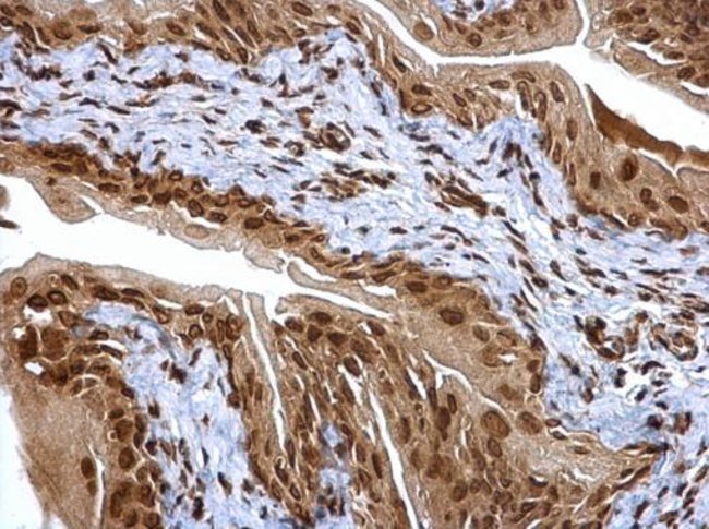 20S Proteasome alpha6 Polyclonal Antibod
