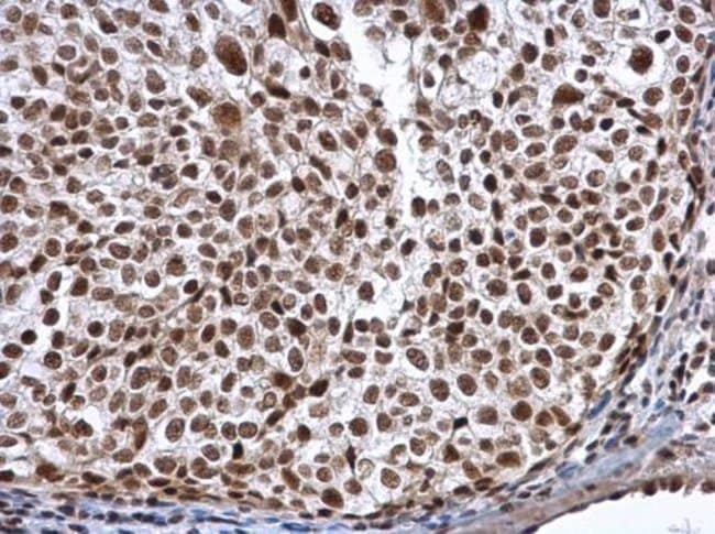 ALY Polyclonal Antibody, 100 µl