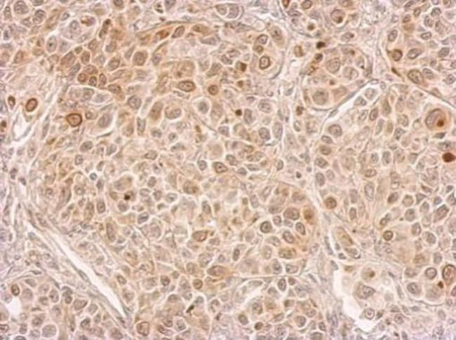 Anamorsin Polyclonal Antibody, 100 µg