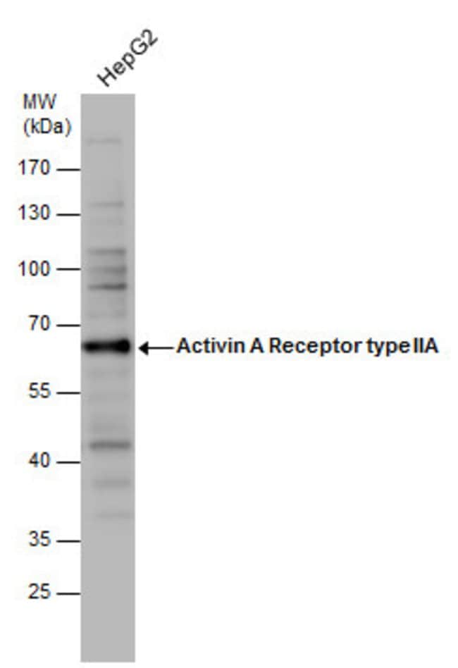 ACTR-II Polyclonal Antibody, 100 µl