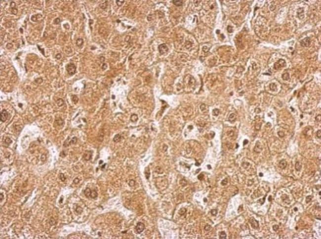 AMPK gamma-2 Polyclonal antibody, 100 µl