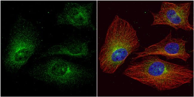 ALPPL2 Polyclonal Antibody, 100 µg