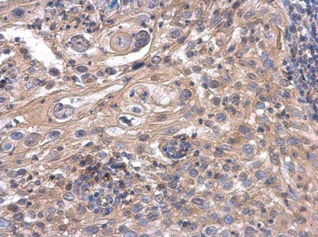 ACOX3 Polyclonal Antibody, 100 µg