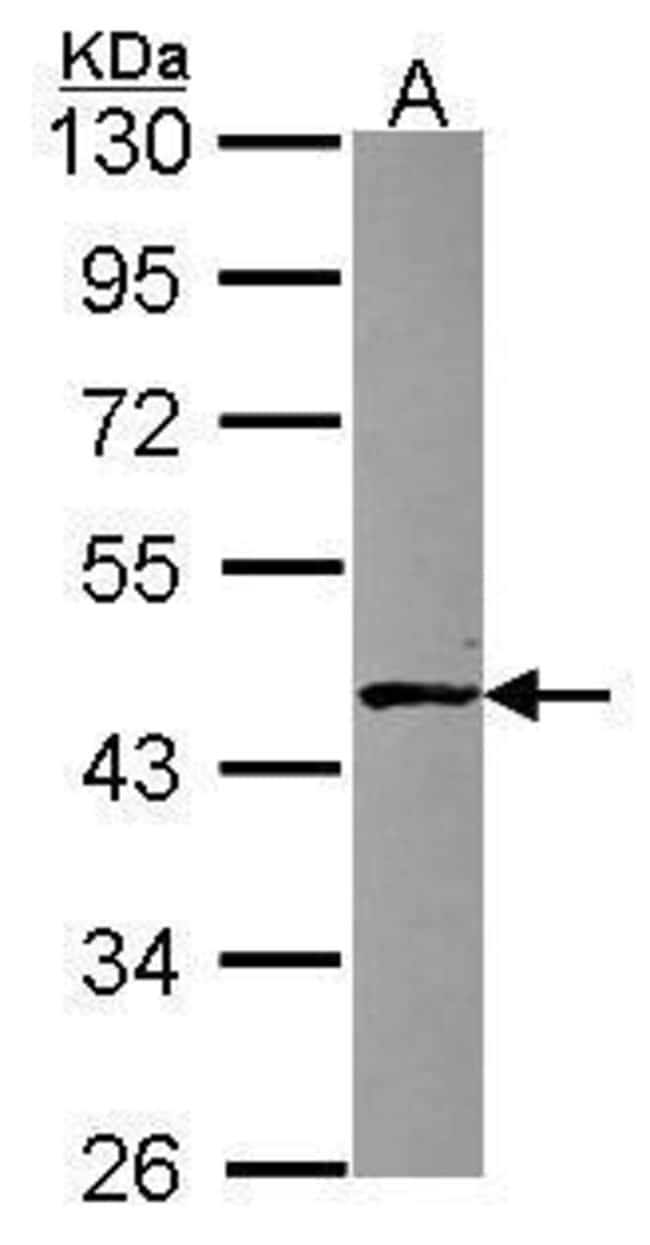 ABH1 Polyclonal Antibody, 100 µg